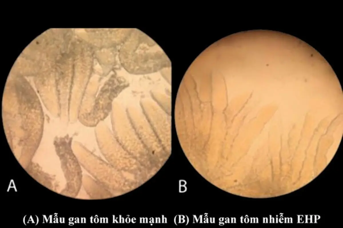 tom-bi-ky-sinh-trung_1726628134